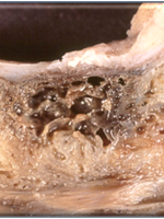 Käkbensinfektion_foto_Jerry Bouquot.png