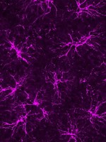 astrocyter magenta.jpg
