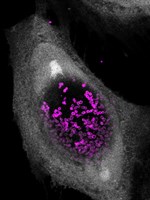 Klamydia infekterar cell Lana Jachman.jpg